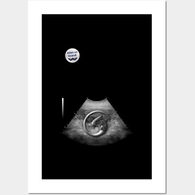 Alien on Board - Ultrasound - badge variant Wall Art by adam@adamdorman.com